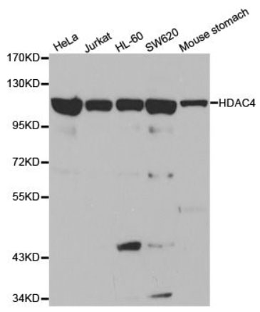 HDAC4 Polyclonal Antibody