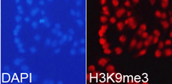 Histone H3K9me3 (H3K9 Trimethyl) Polyclonal Antibody