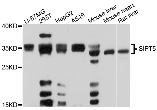 SIRT5 Polyclonal Antibody