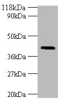 HLA-G Polyclonal Antibody