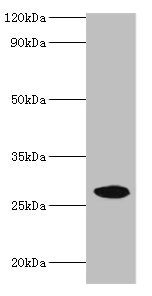 NMNAT3 Polyclonal Antibody