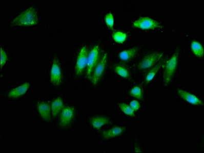 CHAC1 Polyclonal Antibody