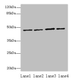 EVA1C Polyclonal Antibody