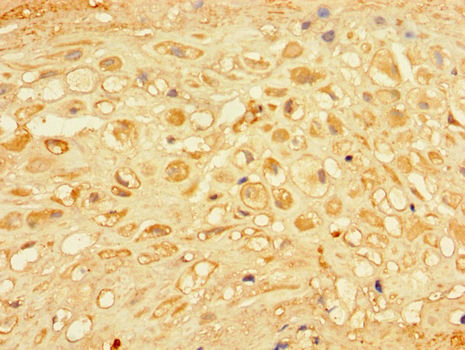 CHM Polyclonal Antibody