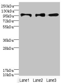 HKDC1 Polyclonal Antibody