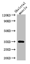 ANKRD23 Polyclonal Antibody