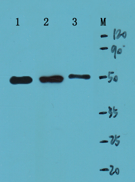 ATAT1 Polyclonal Antibody