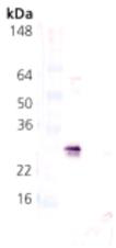 HSP27 (pSer78) Polyclonal Antibody