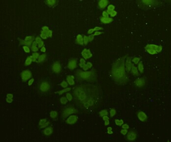 Ubiquitin Polyclonal Antibody