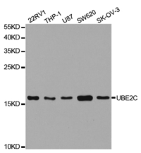 UBE2C Polyclonal Antibody