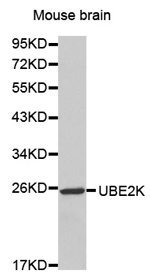 UBE2K Polyclonal Antibody