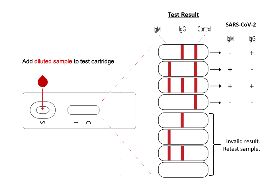 SeroFlash SARS-CoV-2 IgM/IgG Antibody Detection Kit