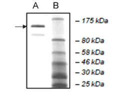 JARID1A Protein