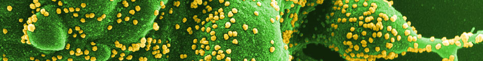 Close-up electron micrograph of apoptotic cell heavily infected with SARS-CoV-2 virus particles