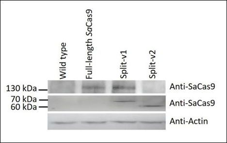 Expanding the Frontiers of Plant Genome Editing with Split SaCas9