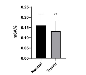 Epigenetic Study Reveals How RNA Methylation Changes Drive Lung Cancer Progression