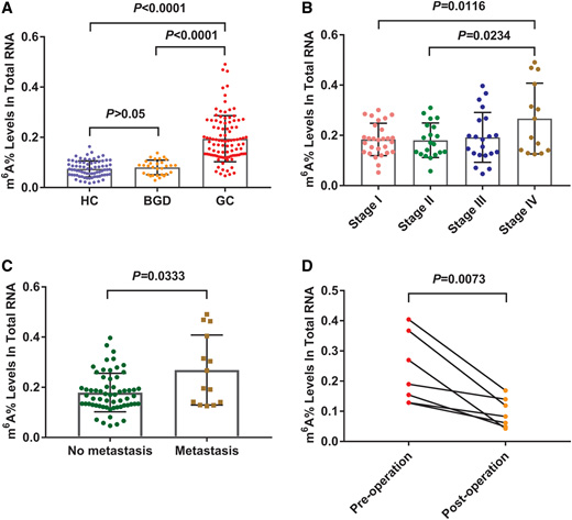 m6A As An Effective Biomarker for Gastric Cancer