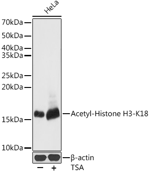 Histone H3K18ac (Acetyl H3K18) Polyclonal Antibody (100 µl)