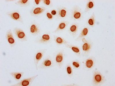 Histone H4K79ac (Acetyl H4K79) Polyclonal Antibody