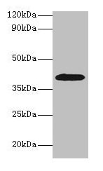 ADH1B Polyclonal Antibody (100 µl)