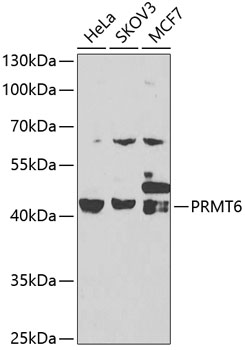 PRMT6 Polyclonal Antibody (100 µl)