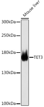 TET3 Polyclonal Antibody (100 µl)