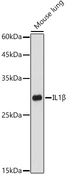 IL1B Polyclonal Antibody (100 µl)