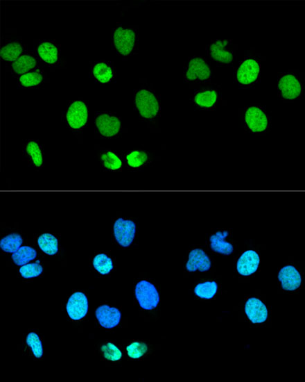 Histone H2AX Polyclonal Antibody | EpigenTek