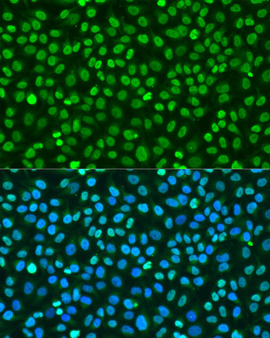 Histone H2AX Polyclonal Antibody | EpigenTek