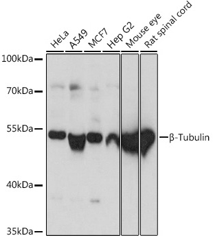 TUBB Polyclonal Antibody