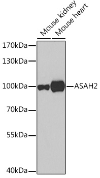 ASAH2 Polyclonal Antibody (100 µl)