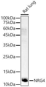 NRG4 Polyclonal Antibody