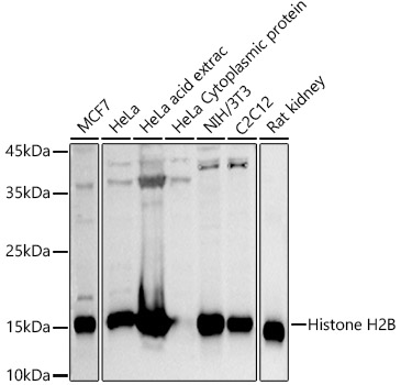 Histone H2B Polyclonal Antibody (50 µl)
