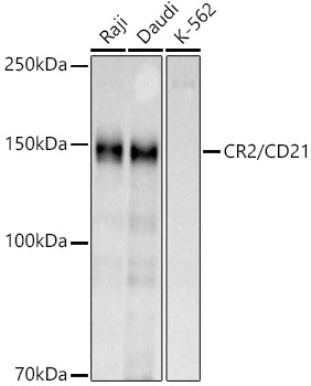 CR2 Polyclonal Antibody (100 µl)