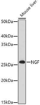 NGF Polyclonal Antibody (100 µl)