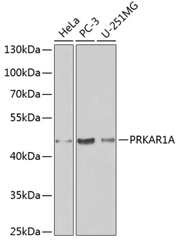 PRKAR1A Polyclonal Antibody (50 µl)