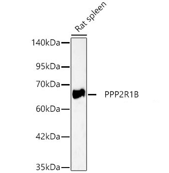 PPP2R1B Polyclonal Antibody