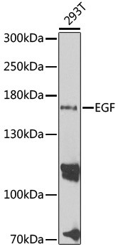 STIM1 Polyclonal Antibody