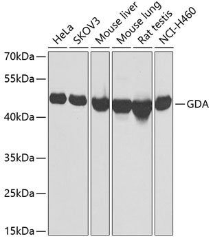 GDA Polyclonal Antibody (50 µl)