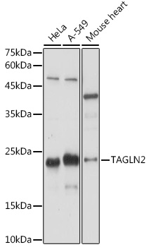 TAGLN2 Polyclonal Antibody