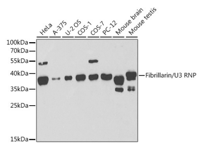 Fibrillarin/U3 RNP Polyclonal Antibody