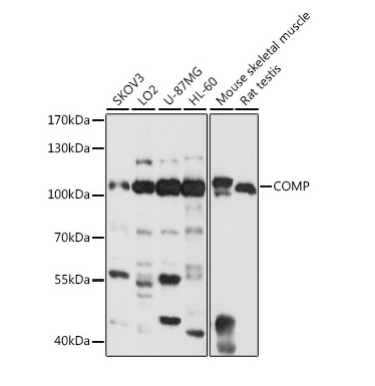 COMP Polyclonal Antibody
