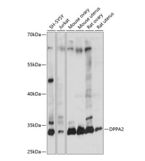 DPPA2 Polyclonal Antibody