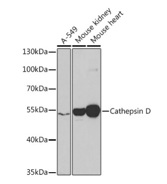 Cathepsin D Polyclonal Antibody