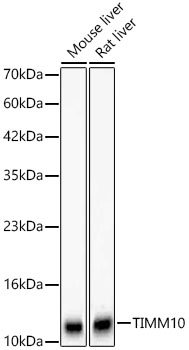 TIMM10 Monoclonal Antibody&nbsp;<img src="images/icon_newarrival.gif" alt="new" border="0">