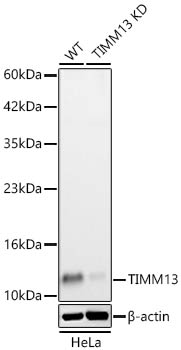 TIMM13 Monoclonal Antibody&nbsp;<img src="images/icon_newarrival.gif" alt="new" border="0">
