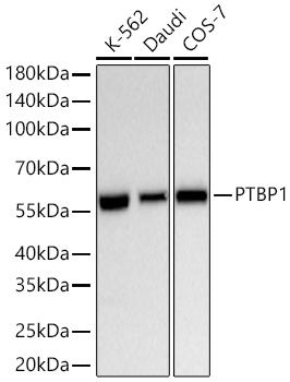 PTBP1 Monoclonal Antibody&nbsp;<img src="images/icon_newarrival.gif" alt="new" border="0">
