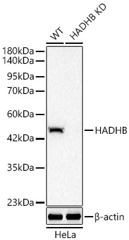 HADHB Monoclonal Antibody&nbsp;<img src="images/icon_newarrival.gif" alt="new" border="0">