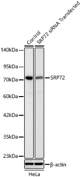 SRP72 Monoclonal Antibody&nbsp;<img src="images/icon_newarrival.gif" alt="new" border="0">