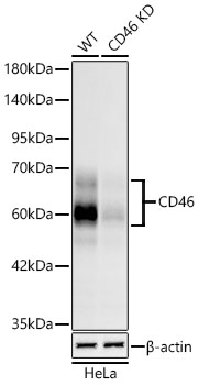 CD46 Monoclonal Antibody&nbsp;<img src="images/icon_newarrival.gif" alt="new" border="0">
